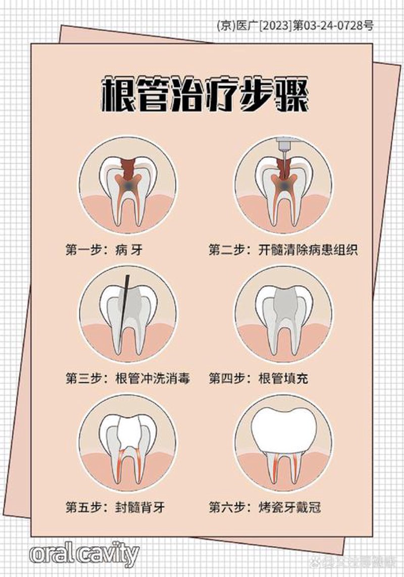 洗牙多少钱?带你了解隐形的省钱之道