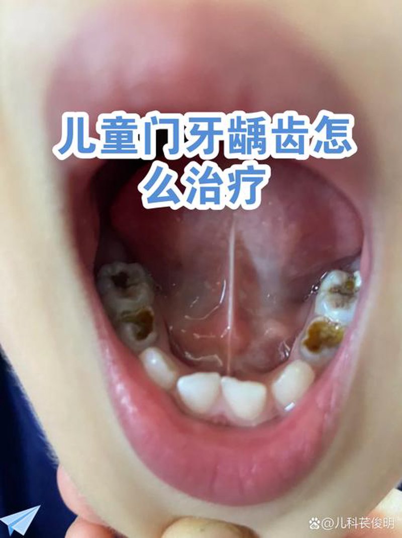 苏州牙科选购指南：寻找最合适的口腔医院