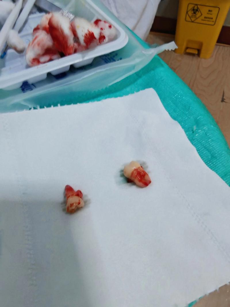 苏州口腔医院:守护您的微笑密码